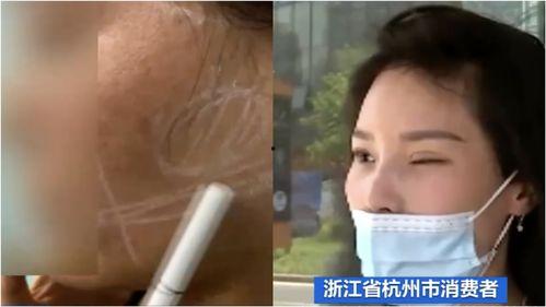 央视爆料医美打针视频大全,央视曝光视频大全  第1张